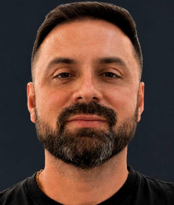 Estruturação facial masculina. - Depois